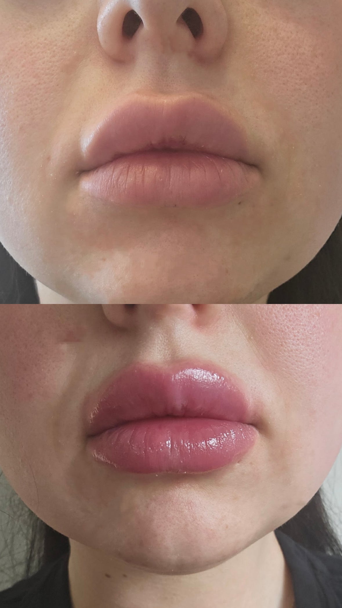 Extreme Lip Plumper